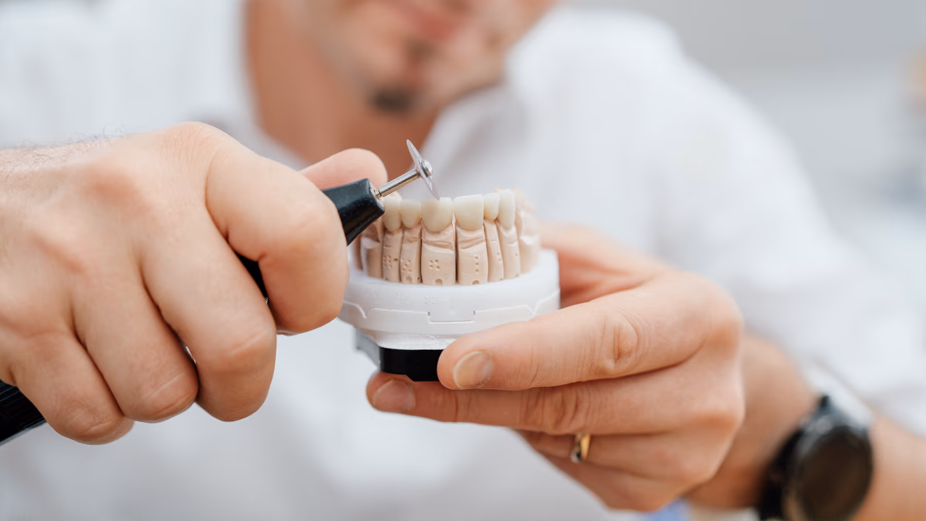 Präzise Feinarbeit an einem Zahnersatzmodell – manuelle Bearbeitung der Zahnkronen im Dentallabor
